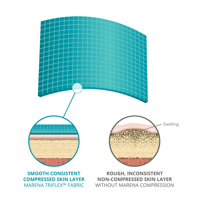 TriFlex™ Fabric Advantage Compression Fabric The Marena Group, LLC